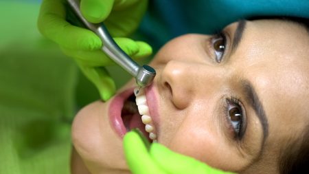 Dentist preparing to drill central incisor preparing tooth for sealant placement