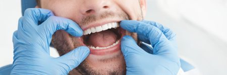 Man having teeth examined at dentists. Overview of dental caries prevention