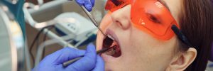 Dentist examines patient's tooth with black cavity on it using dental tools and mirror. Tooth decay in opening mouth closeup.