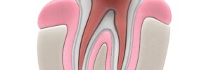 3d renderings of endodontics - root canal procedure