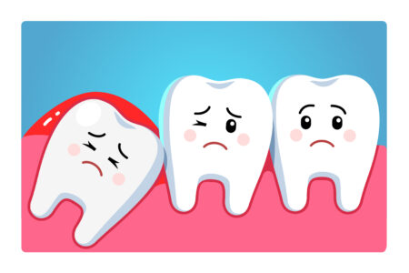 Impacted wisdom tooth character pushing adjacent teeth causing inflammation, toothache, gum pain. Third molar tooth problem. Dentistry and dental surgery clipart. Flat style vector illustration