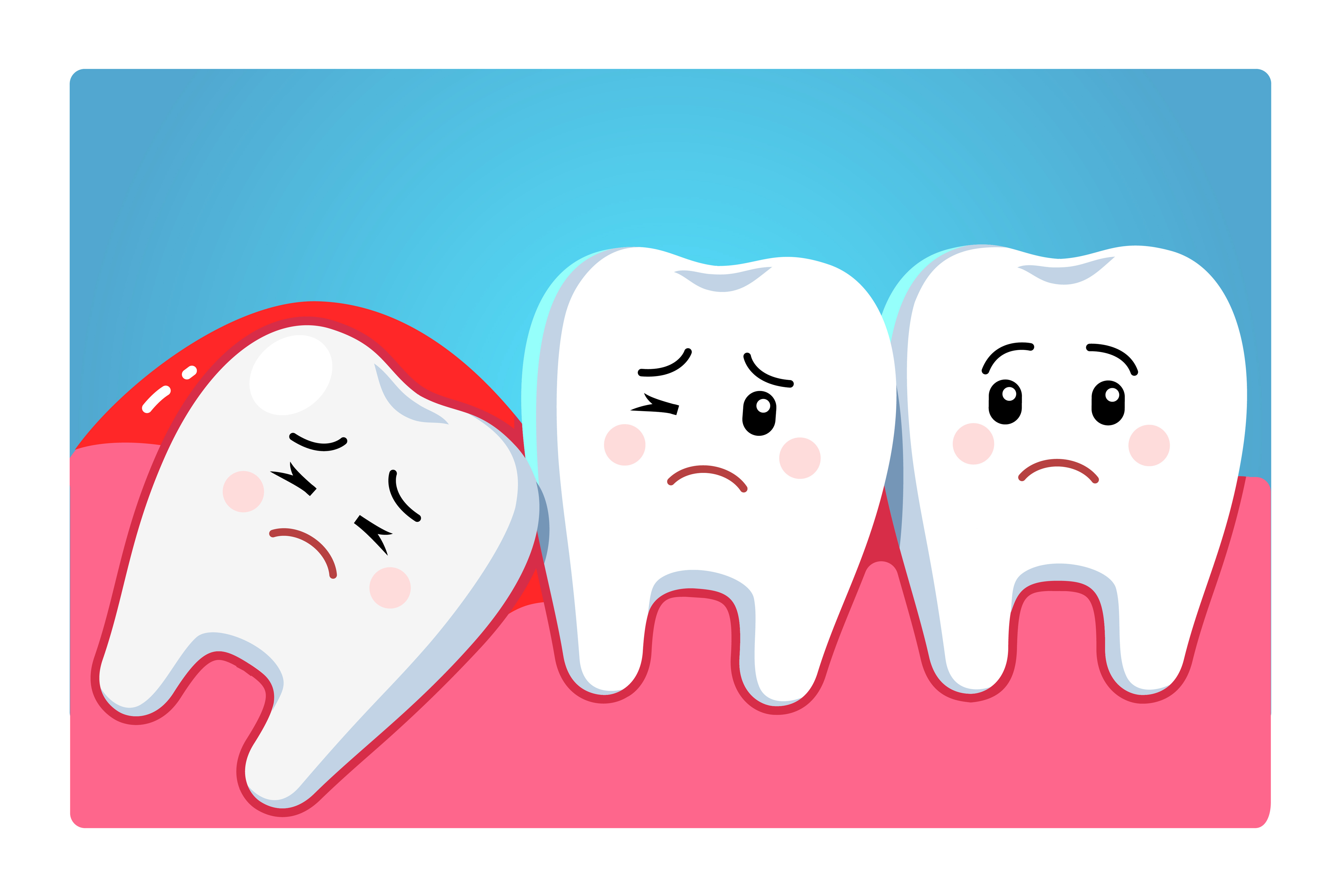 Should You Have Wisdom Teeth Removed Overland Park KS