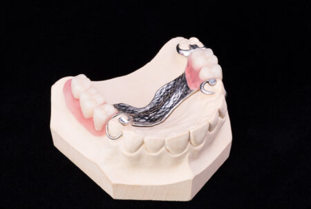 overland park partial denture