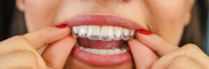 Overland Park, KS, dentist offers Invisalign